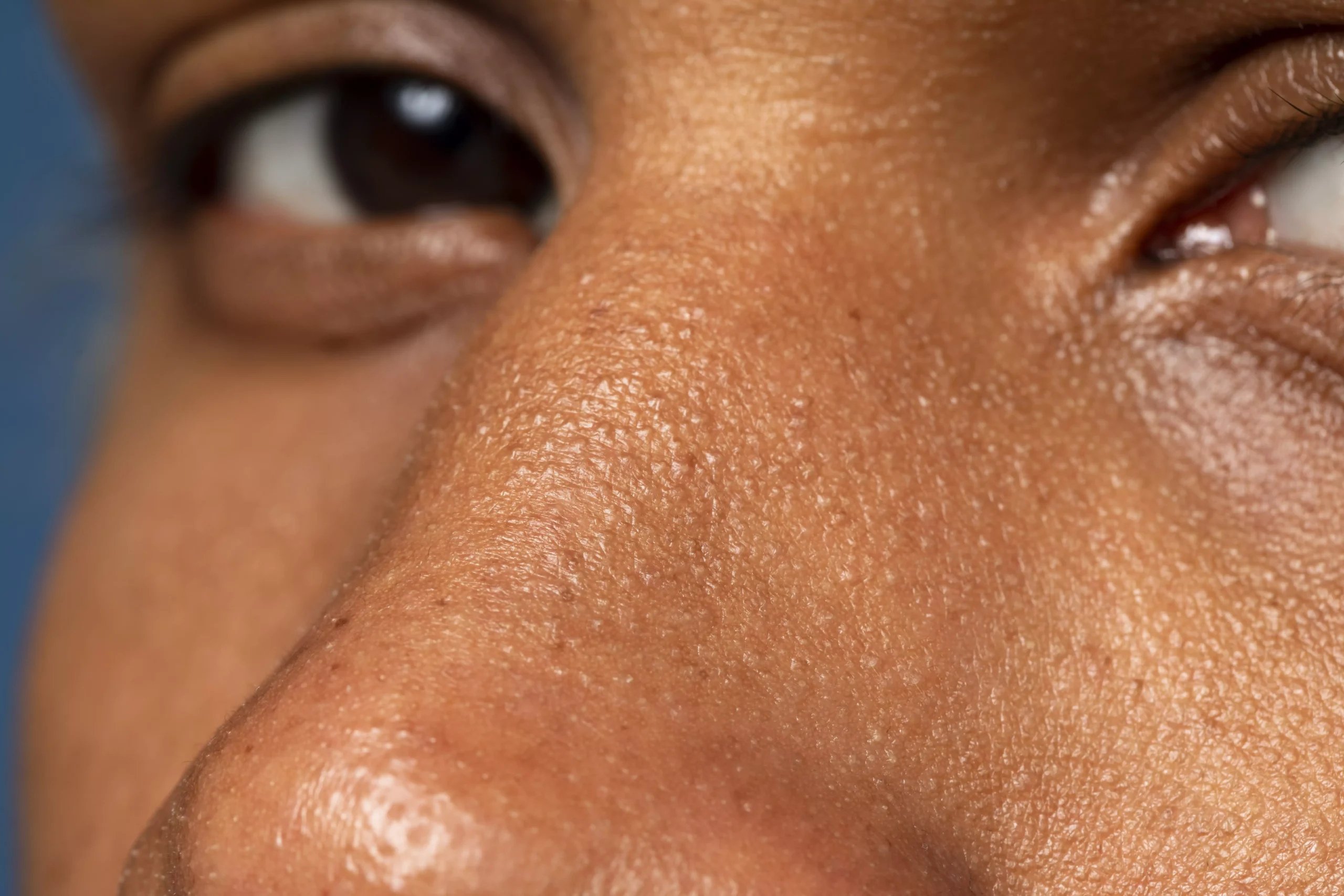 What Does Oily Skin Actually Mean?